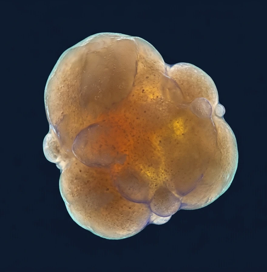Organoïde cérébral humain adulte
